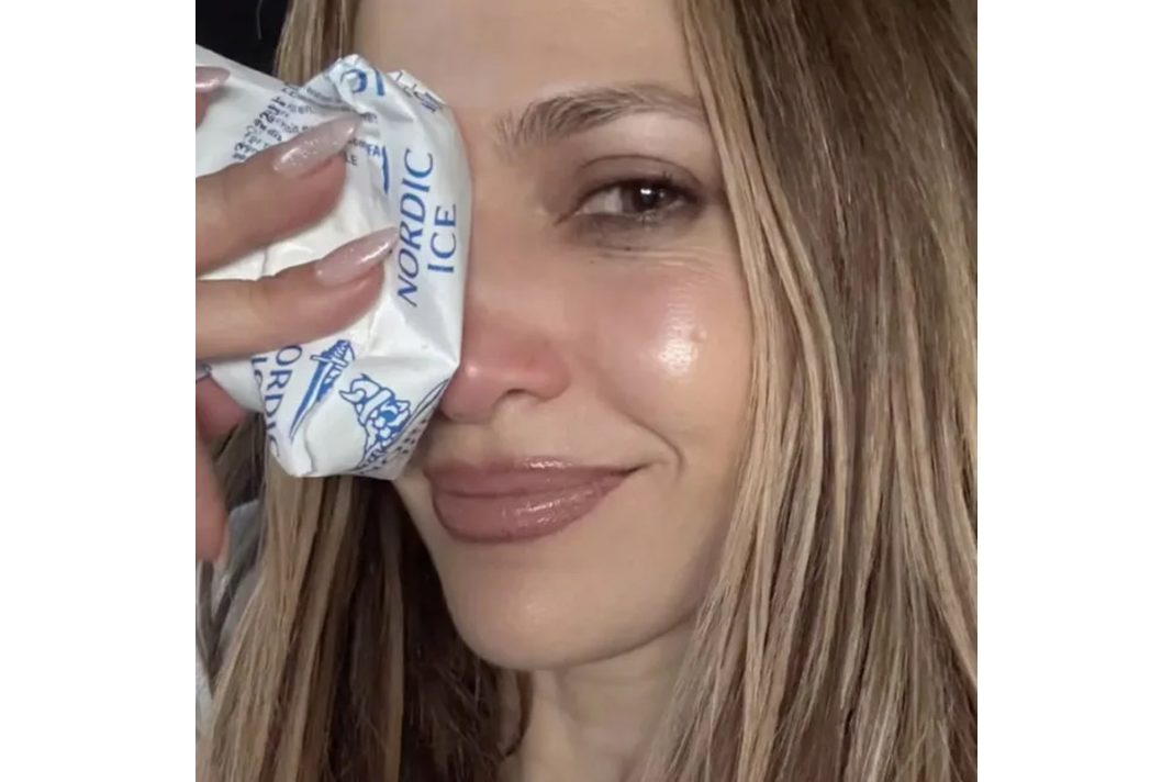 Jennifer Lopez cedera di wajah saat latihan jennifer lopez cedera di wajah saat latihan